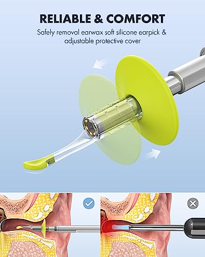 Digital Otoscope with 4.5 Inches Screen, 3.9mm Ear Scope Camera with 6 Lights, 32GB Card O441