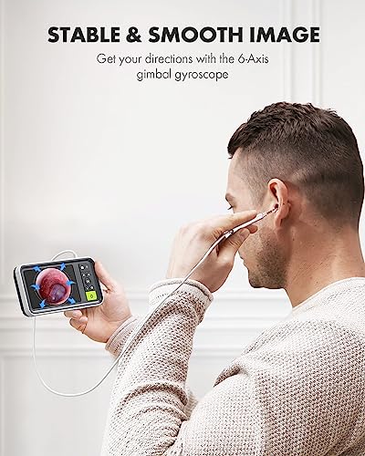 Digital Otoscope with 4.5 Inches Screen, 3.9mm Ear Scope Camera with 6 Lights, 32GB Card O441