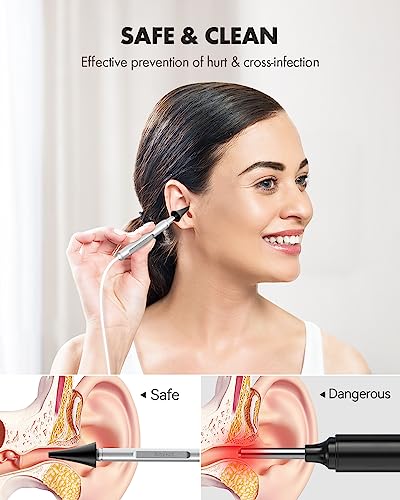 Digital Otoscope with 4.5 Inches Screen, 3.9mm Ear Scope Camera with 6 Lights, 32GB Card O441