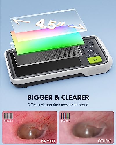 Digital Otoscope with 4.5 Inches Screen, 3.9mm Ear Scope Camera with 6 Lights, 32GB Card O441