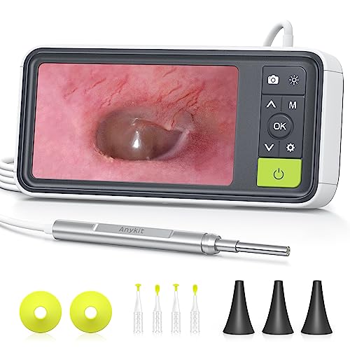 Digital Otoscope with 4.5 Inches Screen, 3.9mm Ear Scope Camera with 6 Lights, 32GB Card O441