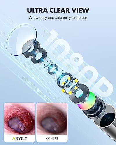 Digital Otoscope with 4.5 Inches Screen, 3.9mm Ear Scope Camera with 6 Lights, 32GB Card O441