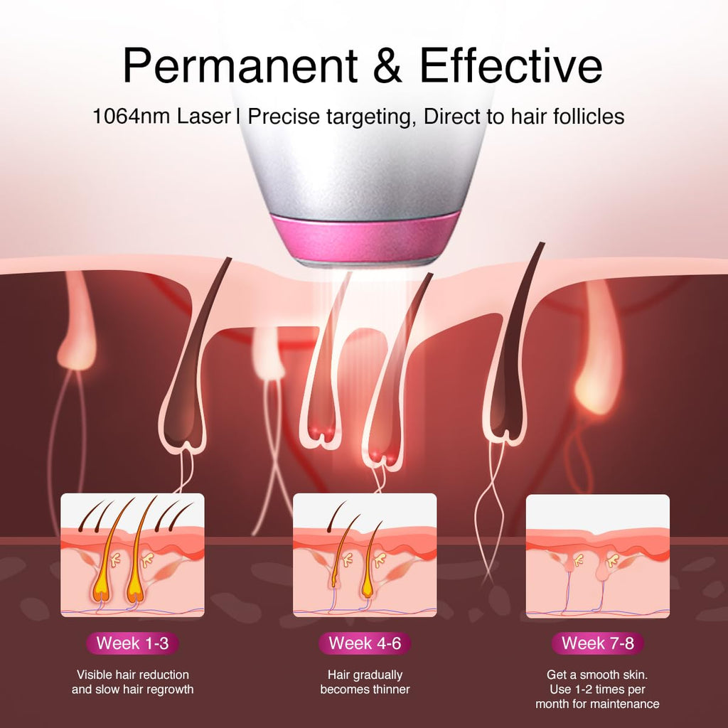 1064nm Diode Laser Hair Removal for Dark Skin Tones V94913